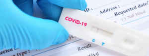 Covid-19 teszt